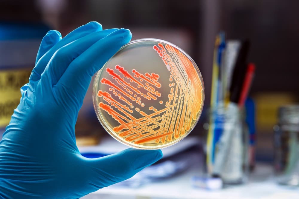 Microbiology Specialization for Medical Laboratory Scientists